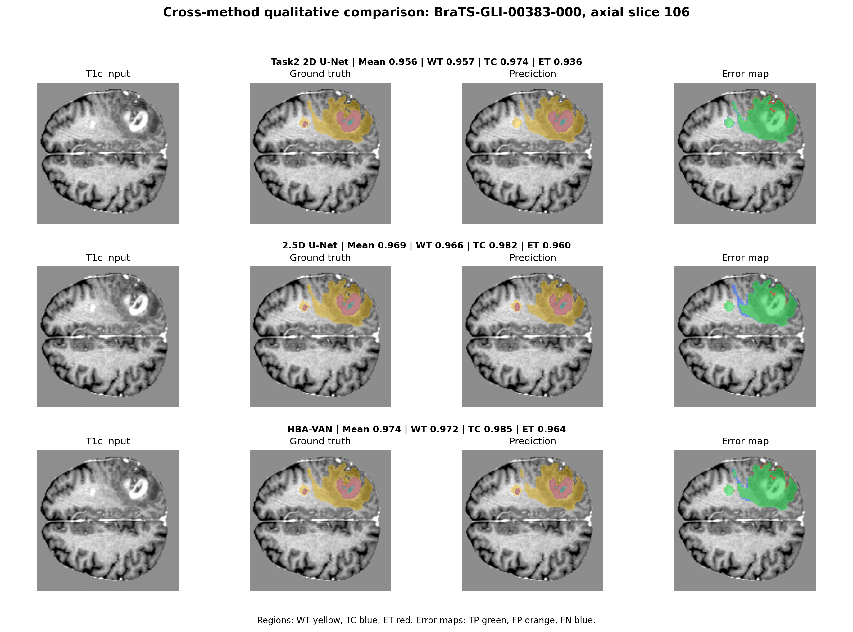 Cross-method qualitative comparison among Task2 2D U-Net, 2.5D U-Net, and HBA-VAN with prediction and error maps.