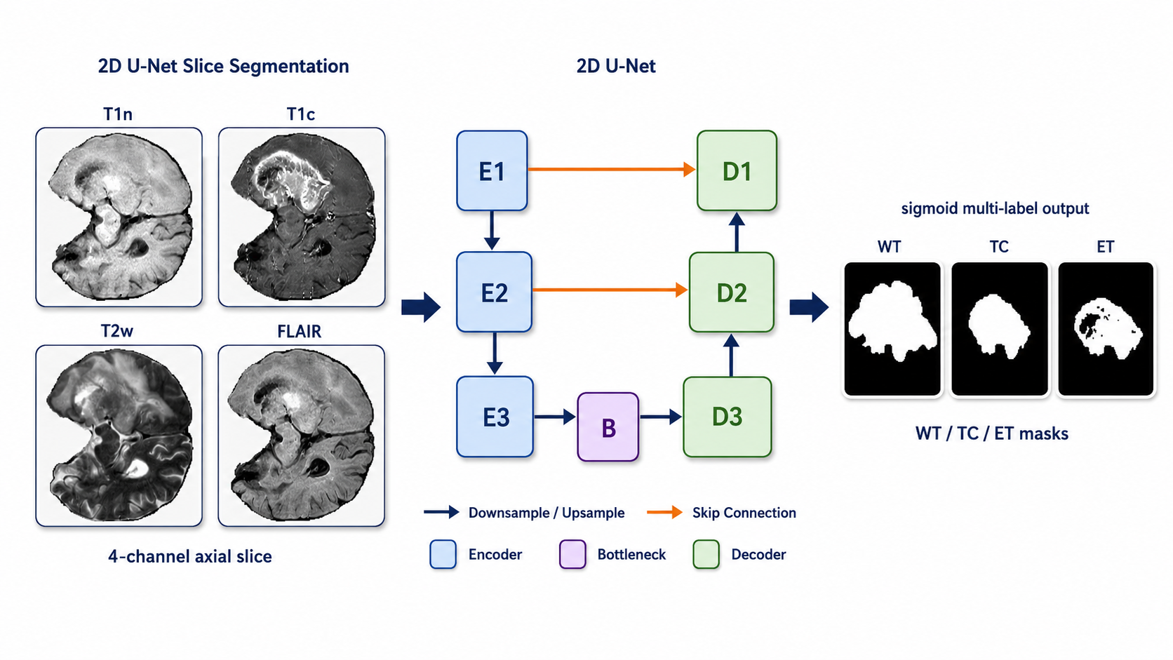 Task2 2D U-Net slice-wise segmentation pipeline with sigmoid WT, TC, and ET outputs.