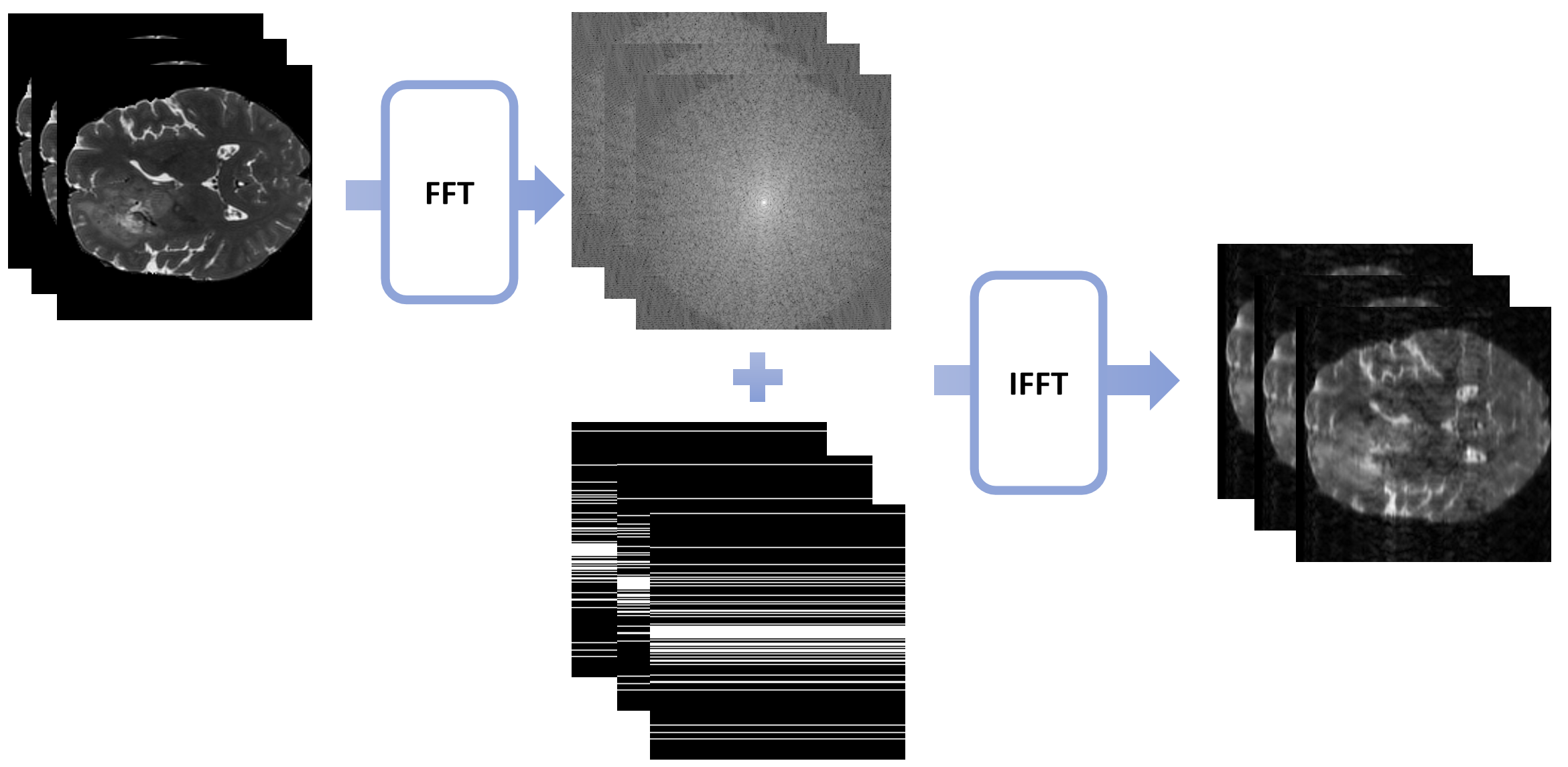 Data processing and k-space undersampling simulation pipeline.
