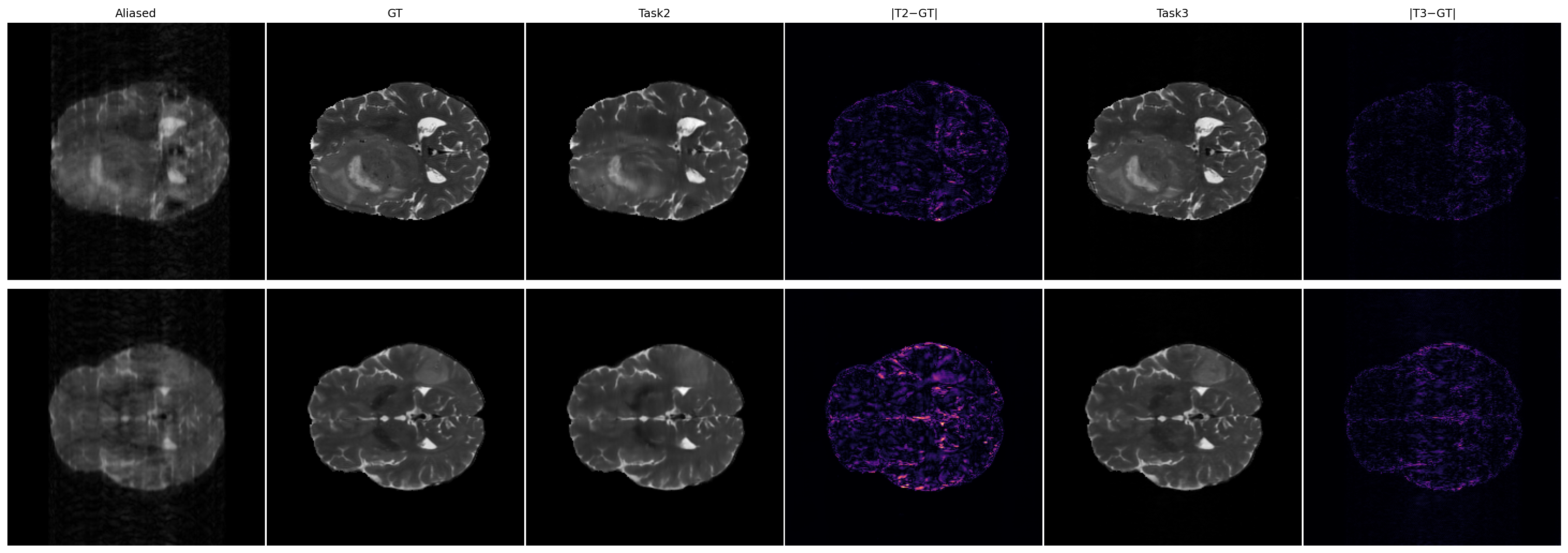 Qualitative comparison between aliased input, ground truth, baseline, and proposed MRI reconstruction.