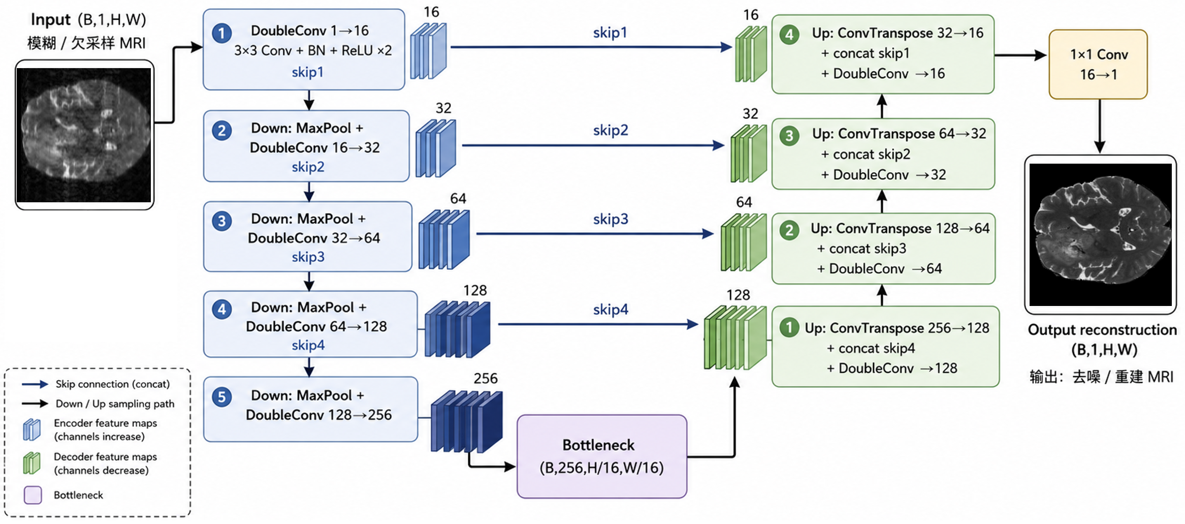 U-Net baseline reconstruction pipeline.